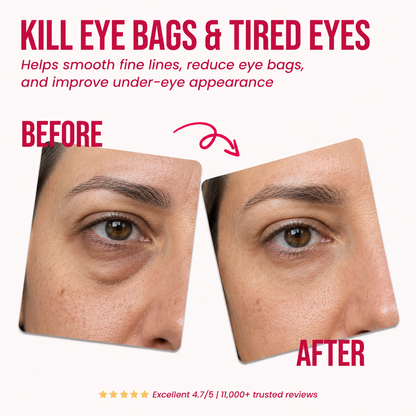 Renew Microneedle Eye Patches